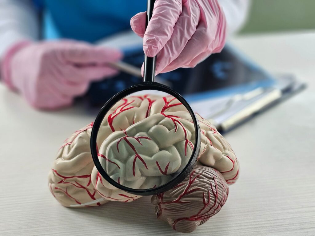 A doctor points a pen at an anatomical brain model over medical paperwork for a Zephyrhills brain injury claim.